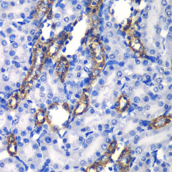 Immunohistochemistry of paraffin-embedded rat kidney using MATK antibody  at dilution of 1:100 