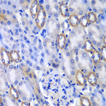 Immunohistochemistry of paraffin-embedded mouse kidney using MATK antibody  at dilution of 1:100 