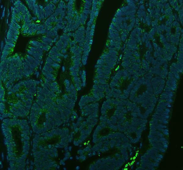 a02050 2 matk primary antibodies if testing 1