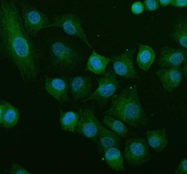 a02050 2 matk primary antibodies if testing 6