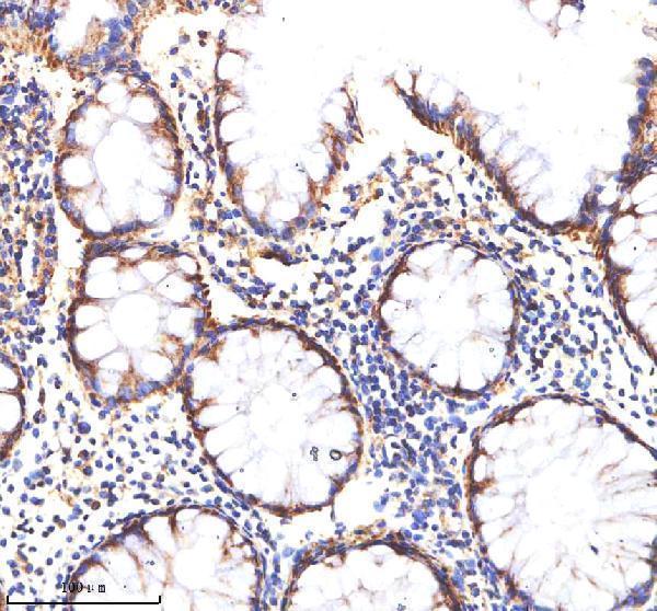  IHC analysis of MATK using anti-MATK antibody (A02050-2)