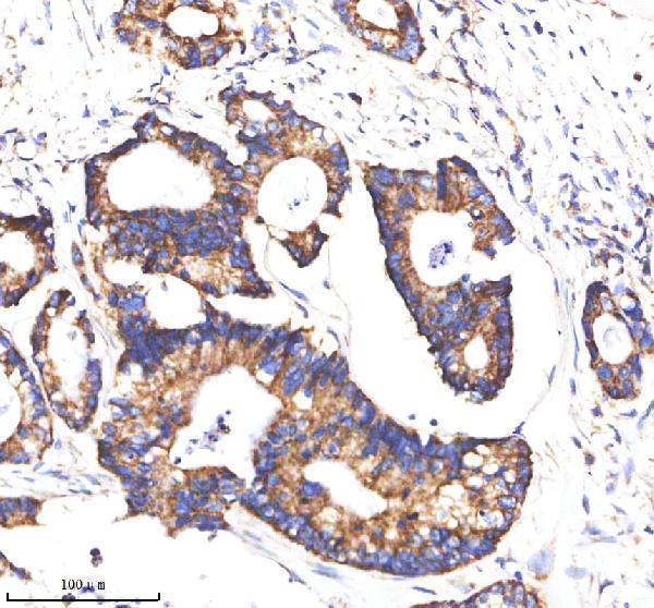  IHC analysis of MATK using anti-MATK antibody (A02050-2)