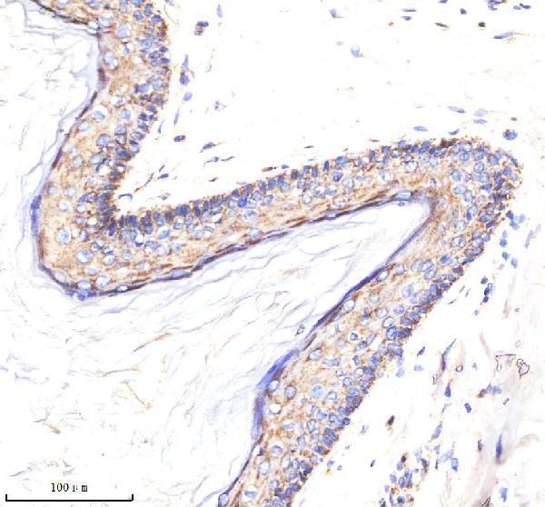 a02050 2 matk primary antibodies ihc testing 4