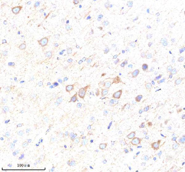 a02050 2 matk primary antibodies ihc testing 5