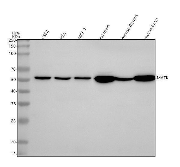  Western blot analysis of MATK using anti-MATK antibody (A02050-2)