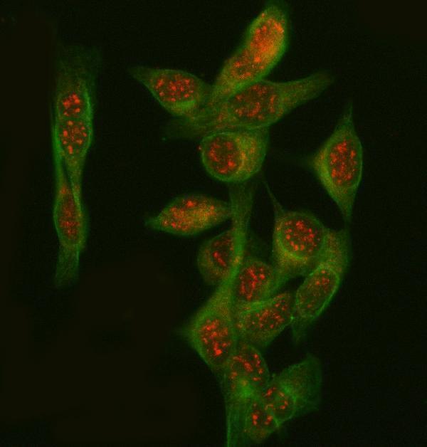 a02052 1 pgm3 primary antibodies if testing 4
