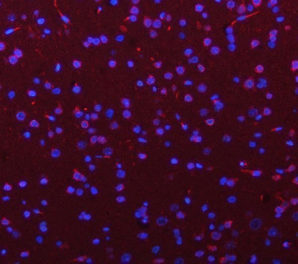 a02052 1 pgm3 primary antibodies if testing 5