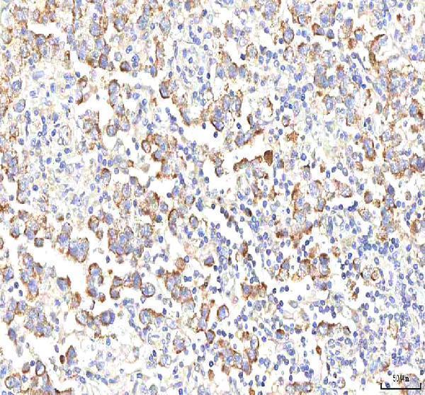  IHC analysis of PGM3 using anti-PGM3 antibody (A02052-1)