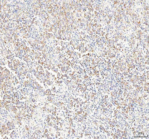  IHC analysis of PGM3 using anti-PGM3 antibody (A02052-1)