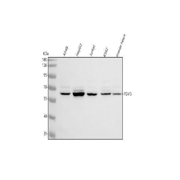  Western blot analysis of PGM3 using anti-PGM3 antibody (A02052-1)