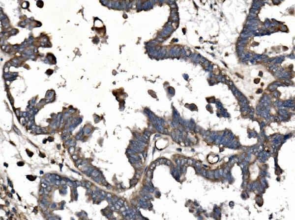 a02053 1 picalm primary antibodies ihc testing 2