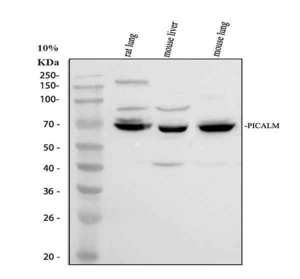 Western blot analysis of PICALM using anti-PICALM antibody (A02053-1)