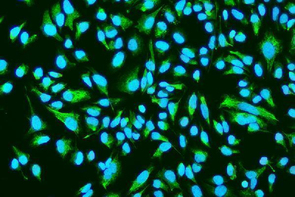 a02055 1 asah1 primary antibodies icc testing 6