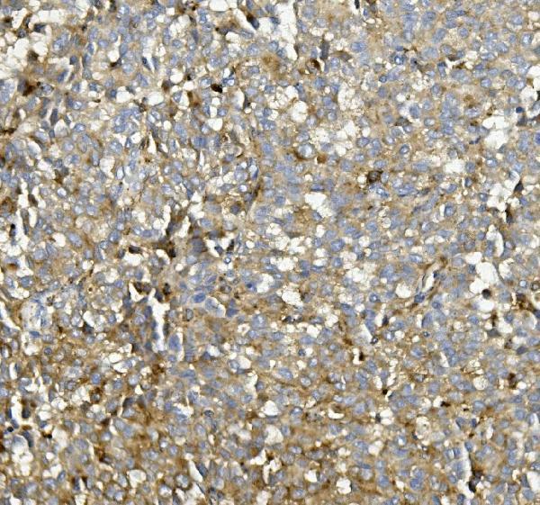 a02055 1 asah1 primary antibodies ihc testing 2
