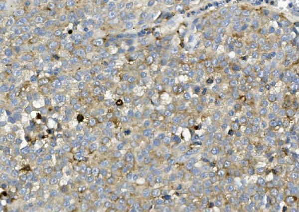 a02055 1 asah1 primary antibodies ihc testing 3