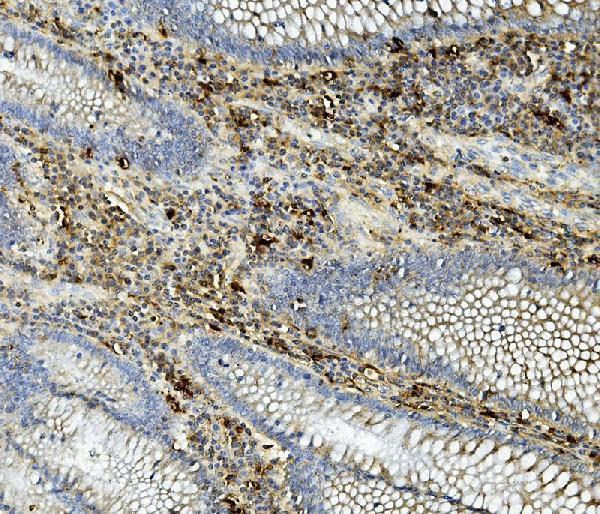 a02055 1 asah1 primary antibodies ihc testing 4
