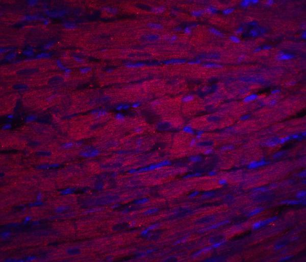 a02055 asah1 primary antibodies if testing 5