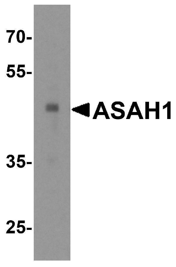a02055 asah1 primary antibodies wb testing 1