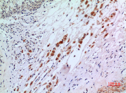 a02056 1 ifnar2 primary antibodies ihc testing 1