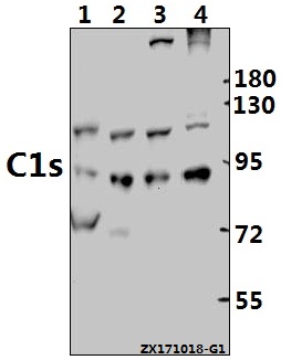 Western blot (WB) analysis of C1s (K583) pAb at 1:500 dilution
Lane1:AML-12 whole cell lysate(40ug)
Lane2:PC12 whole cell lysate(40ug)
Lane3:HepG2 whole cell lysate(40ug)
Lane4:SK-OVCAR3 whole cell lysate(40ug)