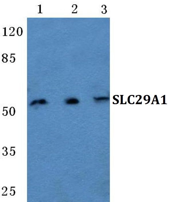 Western blot (WB) analysis of SLC29A1 polyclonal antibody at 1:500 dilution
Lane1:Hela cell lysate
Lane2:Raw264
