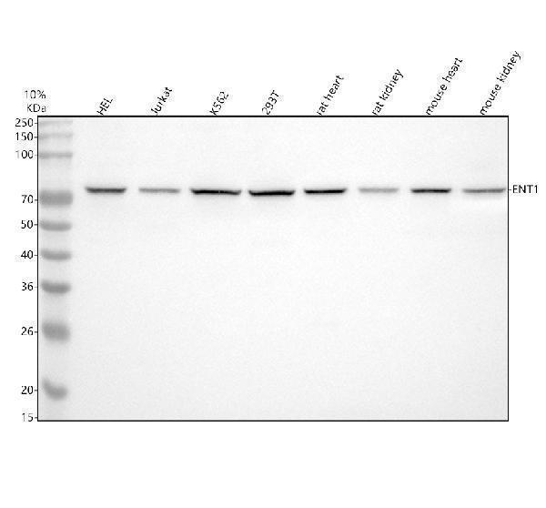  Western blot analysis of ENT1/SLC29A1 using anti-ENT1/SLC29A1 antibody (A02058-2)