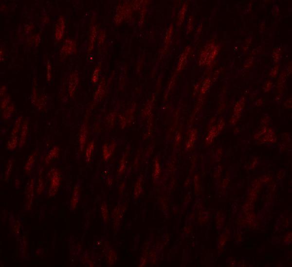 Immunofluorescence of SLC29A1 in human ovary tissue with SLC29A1 antibody at 20 μg/mL