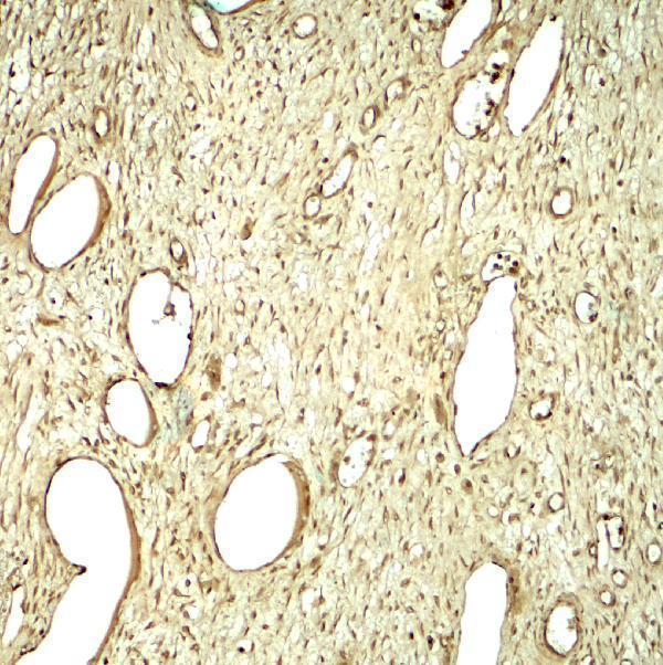 Immunohistochemistry of SLC29A1 in human ovary tissue with SLC29A1 antibody at 5 μg/mL
