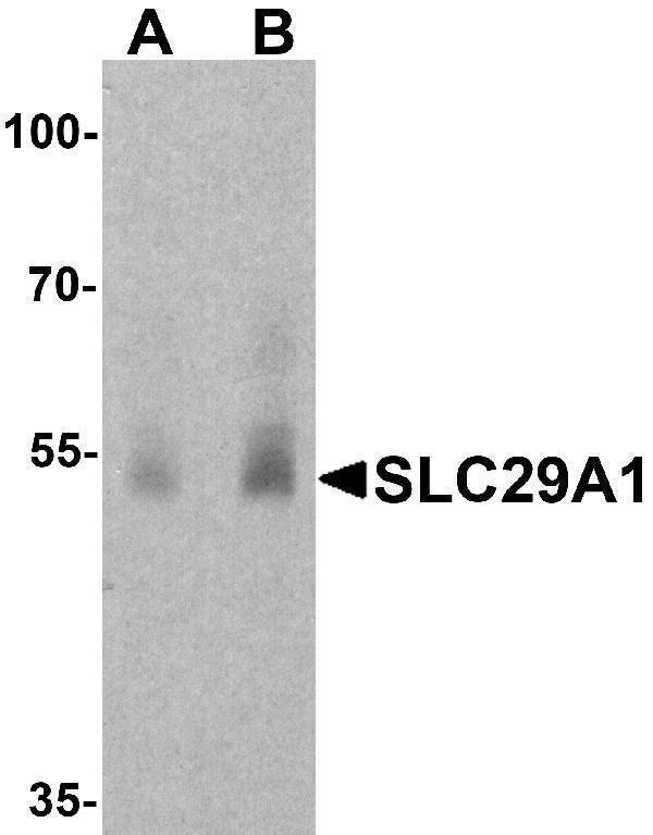 Western blot analysis of SLC29A1 in human ovary tissue lysate with SLC29A1 antibody at (A) 1 and (B) 2 μg/ml