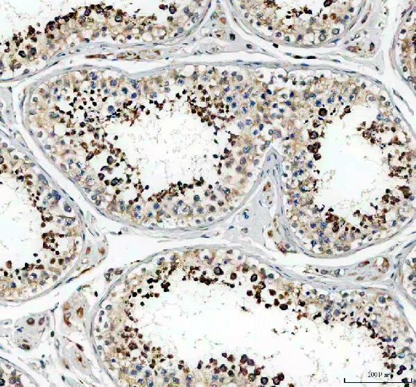 a02059 1 gpx4 primary antibodies ihc testing 1