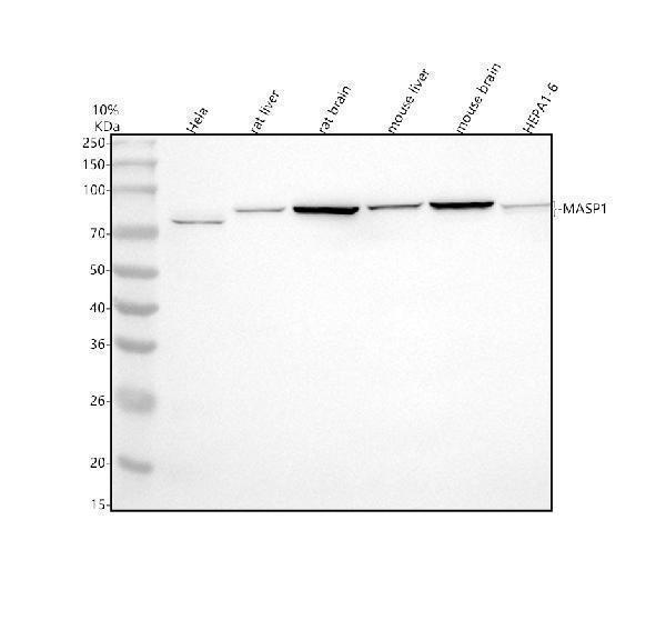  Western blot analysis of MASP1 using anti-MASP1 antibody (A02060-1)