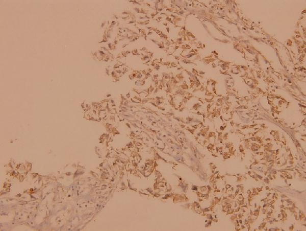 a02061 1 araf primary antiboties ihc testing 2