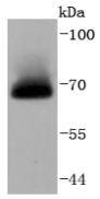 Western blot analysis of A-RAF on Hela cells lysates using anti-A-RAF antibody at 1/1,000 dilution