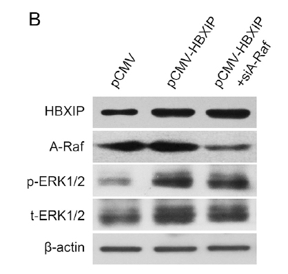 Western blot analysis in MCF-7 cells transfected with siA-Raf