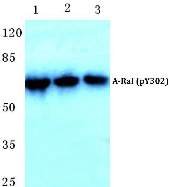 Western blot (WB) analysis of p-ARAF (Y302) polyclonal antibody at 1:500 dilution
Lane1:Hela cell lysate treated with PMA(100nM,15min)
Lane2:sp2/0 cell lysate treated with PMA(100nM,15min)
Lane3:PC12 cell lysate treated with PMA(100nM,15min)