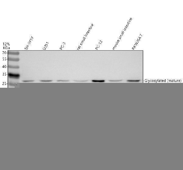 a02062 1 il17f primary antibodies wb testing 1