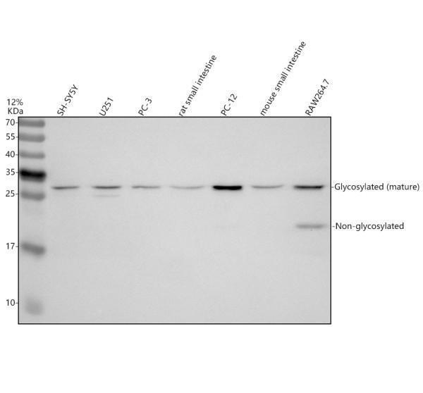 Western blot analysis of IL17F using anti-IL17F antibody (A02062-1)