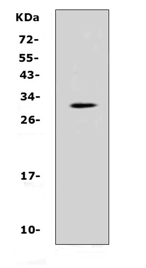  Western blot analysis of IL17F using anti-IL17F antibody (A02062-3)