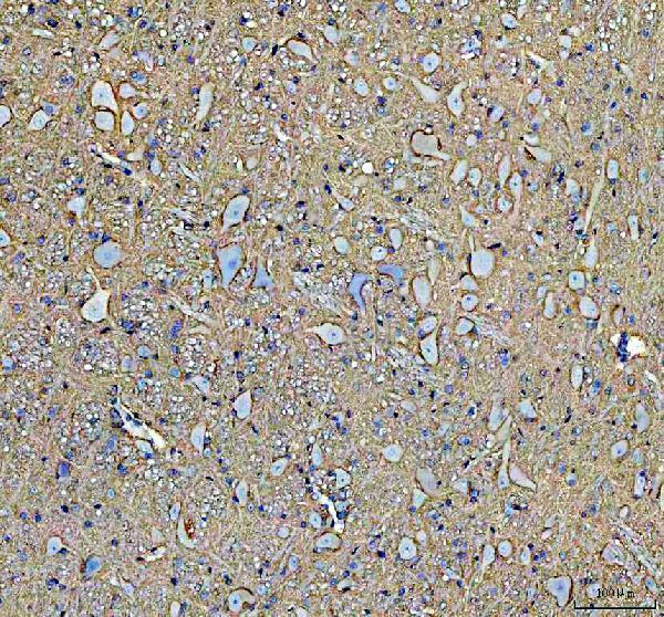 a02064 1 atp1a2 primary antibodies ihc testing 6