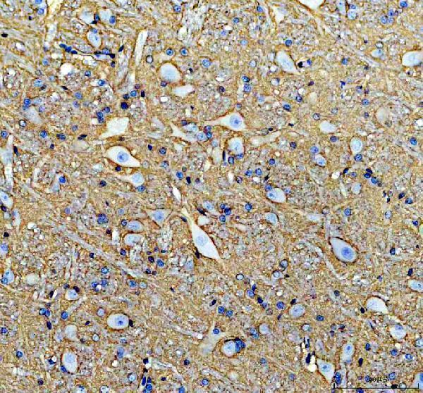 a02064 1 atp1a2 primary antibodies ihc testing 7