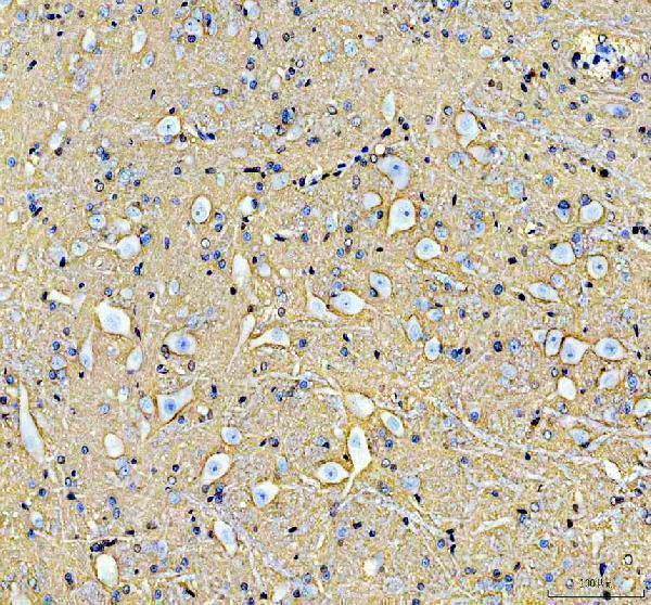 a02064 1 atp1a2 primary antibodies ihc testing 8