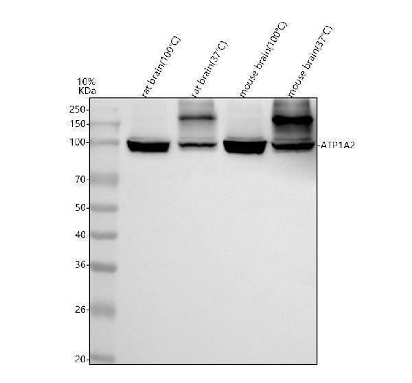  Western blot analysis of ATP1A2 using anti-ATP1A2 antibody (A02064-1)