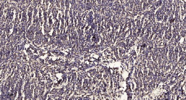 Immunohistochemical analysis of paraffin-embedded human meningioma