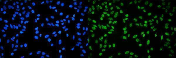 a02067 1 rpa2 primary antibodies if testing 4