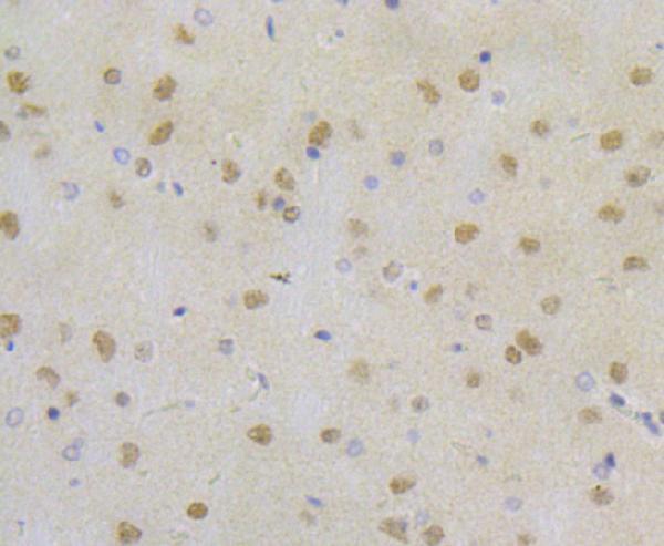 a02067 rpa2 primary antiboties ihc testing 2