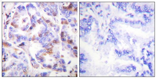 a02067t21 1 rpa2 primary antibodies ihc testing 3