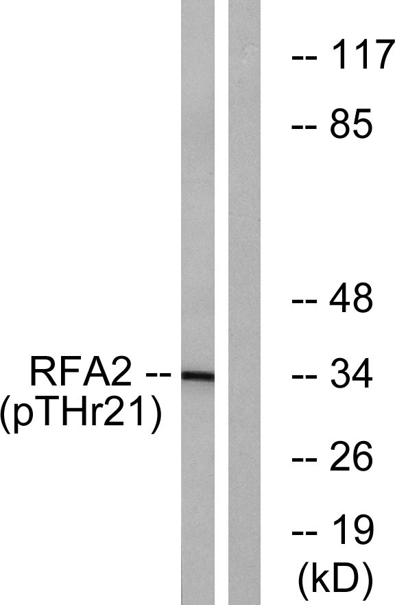 a02067t21 1 rpa2 primary antibodies wb testing 2
