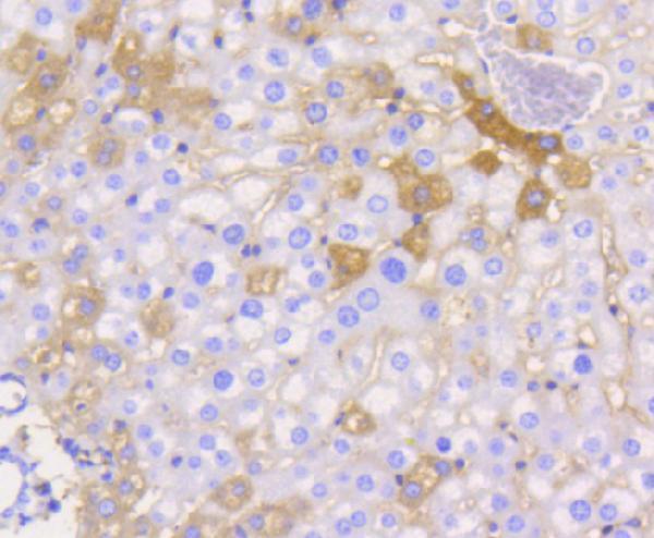 a02068 1 f11r primary antiboties ihc testing 2
