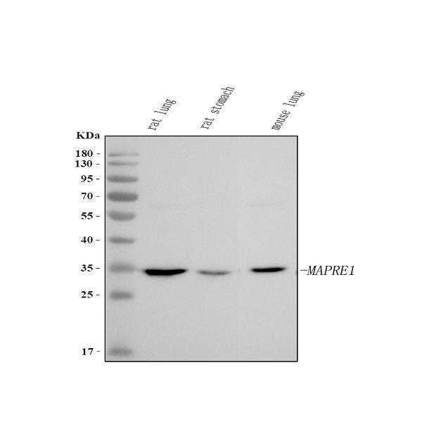  Western blot analysis of EB1/MAPRE1 using anti-EB1/MAPRE1 antibody (A02070-1)