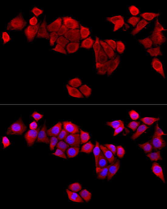 Immunofluorescence analysis of HeLa cells using MAPRE1 antibody  at dilution of  1:100 